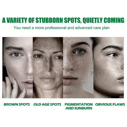 Dark Spot Correcting Glow Serum Fade Pigment Freckle Melasma Melanin Improves Dull Skin Facial Whitening Brightening Essence
