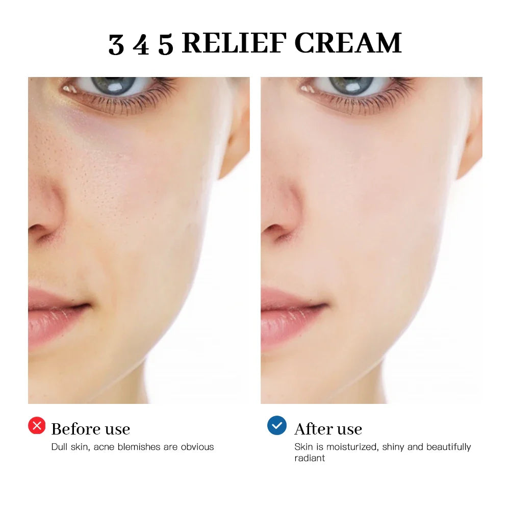 345 Relief Cream Comprehensive solution for skin problems Anti-sugar and antioxidant Brightening skin Improving acne marks Moisturizing