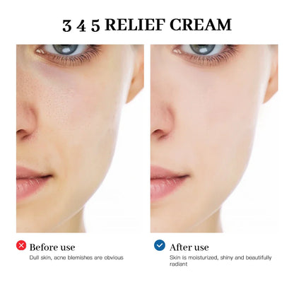 345 Relief Cream Comprehensive solution for skin problems Anti-sugar and antioxidant Brightening skin Improving acne marks Moisturizing