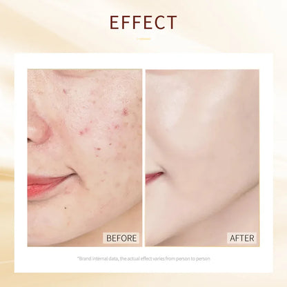 30pcs LAIKOU Sleeping Face Mask Moisturizing Anti-aging Creams Mask No Wash Disposable Facial Mask Skin Care for Beauty